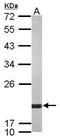 ADP Ribosylation Factor 5 antibody, GTX119329, GeneTex, Western Blot image 