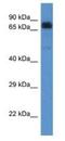 Acyl-CoA Dehydrogenase Family Member 9 antibody, NBP1-74272, Novus Biologicals, Western Blot image 