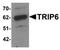 Thyroid Hormone Receptor Interactor 6 antibody, orb75505, Biorbyt, Western Blot image 