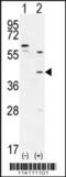 TGFB Induced Factor Homeobox 1 antibody, 56-207, ProSci, Western Blot image 