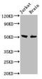 One Cut Homeobox 1 antibody, CSB-PA880058LA01HU, Cusabio, Western Blot image 