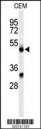 CFP antibody, 64-199, ProSci, Western Blot image 
