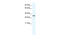 Aryl Hydrocarbon Receptor Interacting Protein antibody, 28-634, ProSci, Enzyme Linked Immunosorbent Assay image 