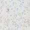 Acetylcholine Receptor antibody, 14-364, ProSci, Immunohistochemistry paraffin image 