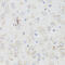 ACHR antibody, 14-364, ProSci, Immunohistochemistry paraffin image 