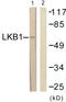STK11 antibody, LS-C117754, Lifespan Biosciences, Western Blot image 