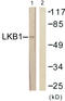 Serine/Threonine Kinase 11 antibody, LS-C117754, Lifespan Biosciences, Western Blot image 