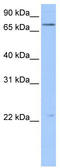 Beaded Filament Structural Protein 1 antibody, TA345764, Origene, Western Blot image 