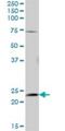 Adenylate Kinase 5 antibody, H00026289-B01P, Novus Biologicals, Western Blot image 