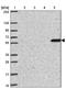 Zinc Finger Protein 100 antibody, NBP2-32429, Novus Biologicals, Western Blot image 