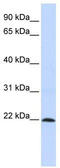 Zinc Finger Protein 581 antibody, TA331910, Origene, Western Blot image 