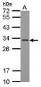 Fibroblast Growth Factor 13 antibody, NBP2-16471, Novus Biologicals, Western Blot image 