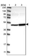 Integrin Alpha FG-GAP Repeat Containing 1 antibody, PA5-54067, Invitrogen Antibodies, Western Blot image 