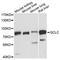 Glutamate-Cysteine Ligase Catalytic Subunit antibody, A1038, ABclonal Technology, Western Blot image 