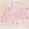 Peroxisomal Biogenesis Factor 14 antibody, LS-C352640, Lifespan Biosciences, Immunohistochemistry frozen image 