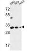 Pyrroline-5-Carboxylate Reductase 1 antibody, AP53528PU-N, Origene, Western Blot image 