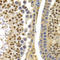 Apolipoprotein B MRNA Editing Enzyme Catalytic Subunit 3G antibody, LS-C331480, Lifespan Biosciences, Immunohistochemistry paraffin image 