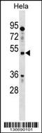 Interleukin-13 receptor subunit alpha-1 antibody, 59-009, ProSci, Western Blot image 