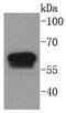 Keratin 6A antibody, NBP2-67705, Novus Biologicals, Western Blot image 