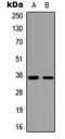 Glucose-dependent insulinotropic receptor antibody, LS-C356072, Lifespan Biosciences, Western Blot image 