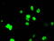 Aryl Hydrocarbon Receptor Nuclear Translocator antibody, LS-C115185, Lifespan Biosciences, Immunofluorescence image 