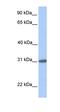 Ankyrin Repeat Domain 46 antibody, orb325866, Biorbyt, Western Blot image 