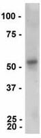 Parkin RBR E3 Ubiquitin Protein Ligase antibody, ab77924, Abcam, Western Blot image 
