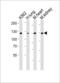 Receptor Tyrosine Kinase Like Orphan Receptor 1 antibody, LS-C99123, Lifespan Biosciences, Western Blot image 