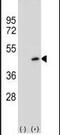Protein Arginine Methyltransferase 6 antibody, PA5-11123, Invitrogen Antibodies, Western Blot image 