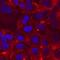 Integrin Subunit Alpha 8 antibody, MAB6194, R&D Systems, Immunocytochemistry image 