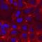 Integrin Subunit Alpha 8 antibody, MAB6194, R&D Systems, Immunocytochemistry image 