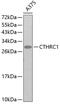 Collagen Triple Helix Repeat Containing 1 antibody, 13-326, ProSci, Western Blot image 