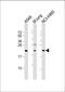 Tumor Suppressor Candidate 1 antibody, GTX03411, GeneTex, Western Blot image 