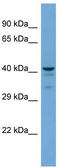 Prostaglandin E Synthase 2 antibody, TA329983, Origene, Western Blot image 