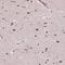 Mediator Complex Subunit 6 antibody, HPA069039, Atlas Antibodies, Immunohistochemistry frozen image 
