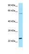 Rac Family Small GTPase 2 antibody, orb331061, Biorbyt, Western Blot image 