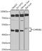 Cholinergic Receptor Nicotinic Beta 2 Subunit antibody, 23-913, ProSci, Western Blot image 