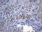 NDUFA4 Mitochondrial Complex Associated Like 2 antibody, LS-C795540, Lifespan Biosciences, Immunohistochemistry paraffin image 