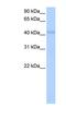 KLH42 antibody, NBP1-91421, Novus Biologicals, Western Blot image 