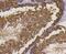 Stathmin 1 antibody, NBP2-67169, Novus Biologicals, Immunohistochemistry paraffin image 