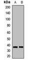 Deoxyribonuclease 1 antibody, LS-C668621, Lifespan Biosciences, Western Blot image 