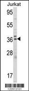 Aminolevulinate Dehydratase antibody, 62-488, ProSci, Western Blot image 