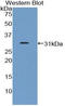 Growth Hormone Receptor antibody, LS-C294362, Lifespan Biosciences, Western Blot image 