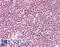 Splicing Factor 3b Subunit 4 antibody, LS-B10383, Lifespan Biosciences, Immunohistochemistry paraffin image 