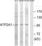 ATPase Sarcoplasmic/Endoplasmic Reticulum Ca2+ Transporting 1 antibody, abx014840, Abbexa, Western Blot image 