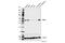 Ribonucleotide Reductase Regulatory Subunit M2 antibody, 65939T, Cell Signaling Technology, Western Blot image 