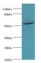 Thyroid Hormone Receptor Beta antibody, LS-C370441, Lifespan Biosciences, Western Blot image 