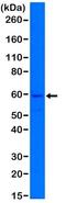 Keratin 5 antibody, NBP2-61524, Novus Biologicals, Western Blot image 