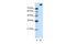 Splicing Factor 3b Subunit 1 antibody, GTX47327, GeneTex, Western Blot image 