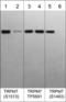 Transient Receptor Potential Cation Channel Subfamily M Member 7 antibody, TP5691, ECM Biosciences, Western Blot image 